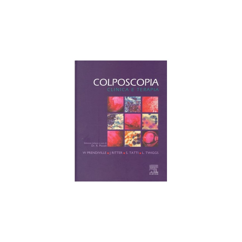 Colposcopia - Clinica e Terapia